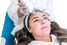 Load image into Gallery viewer, RF (Radio Frequency) Microneedling